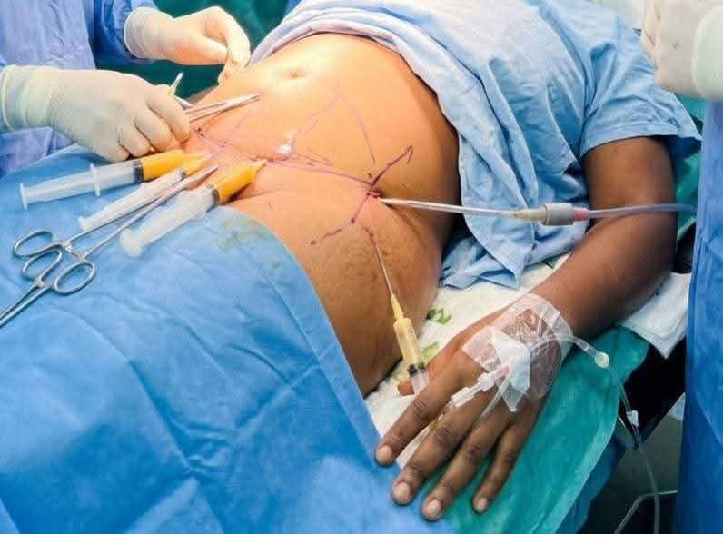 A medical professional in a surgical setting