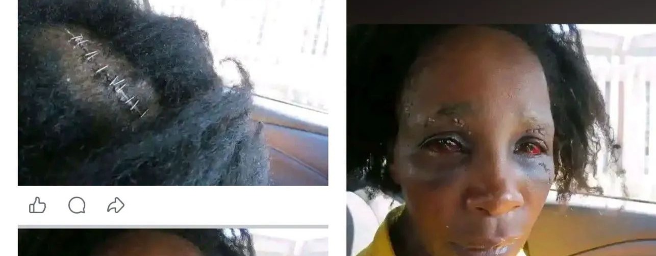 Editorial illustration of domestic violence survivor support and reporting resources in South Africa